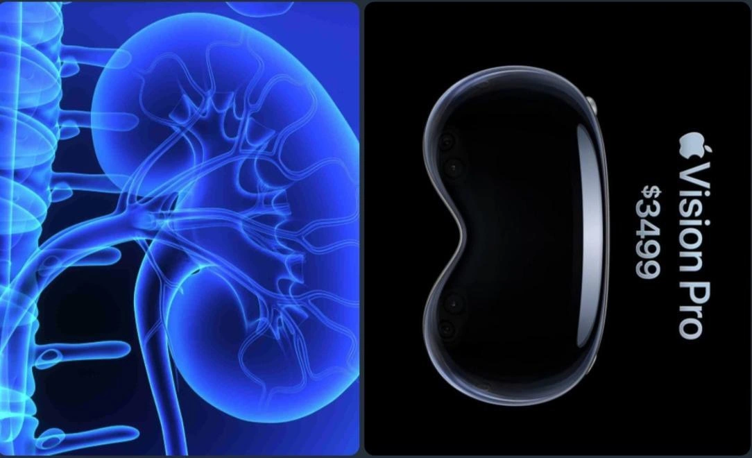 The True Cost of Apple's Vision Pro