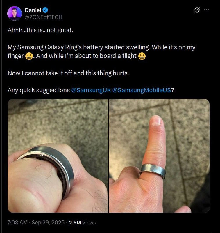 Samsung Galaxy Ring Battery Swelling While On Finger Before Flight